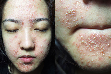 Botched Beauty: Beauty Lessons to Learn from