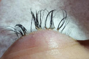 Botched Beauty: Beauty Lessons to Learn from
