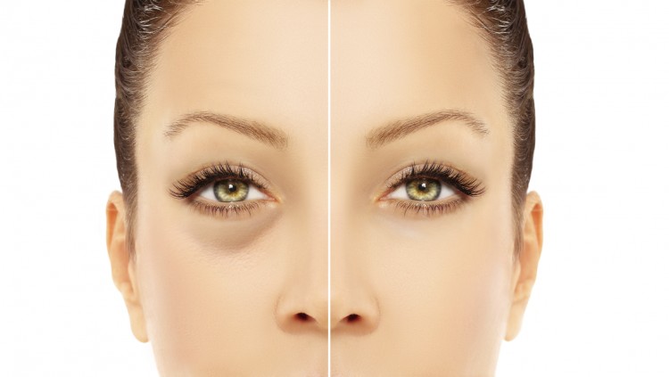 iStock_000055759312_Medium-750x423.jpg