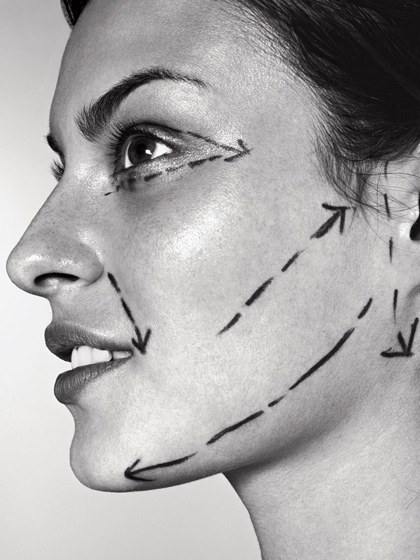 beauty-trends-2013-01-cosmetic-surgery-vampire-face-lift