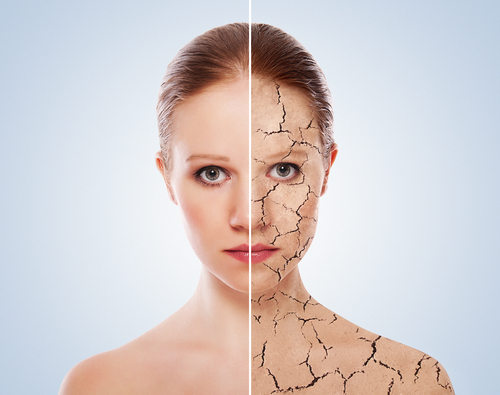 lady-with-dry-cracking-skin