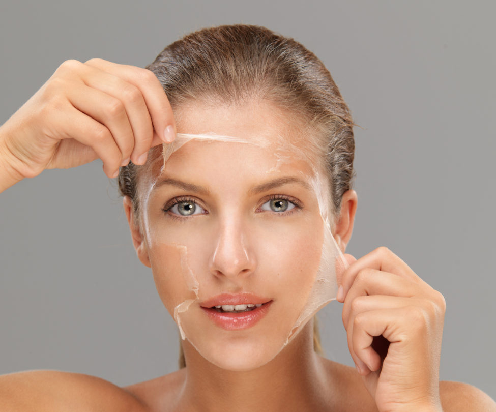 what-is-a-chemical-peel-e1517852109529