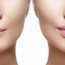 new age botox 