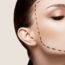 botox-injection-botox-vs-fillers