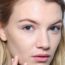Acne-Scar-Types-1