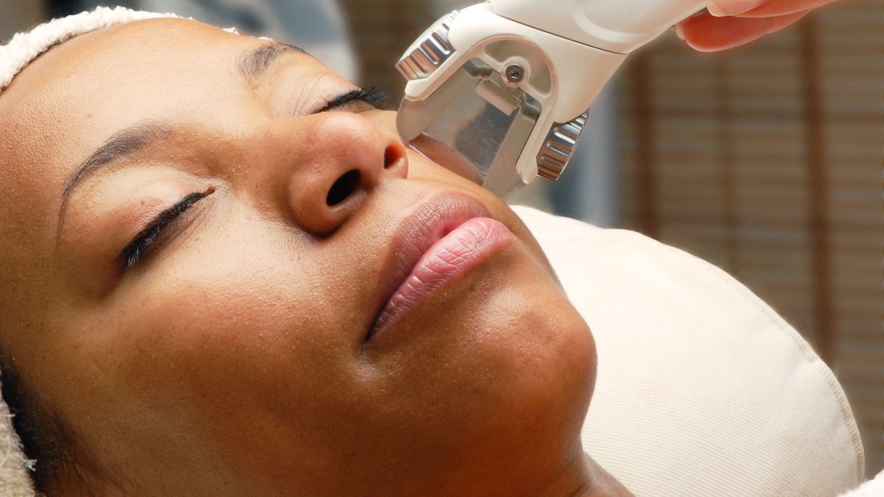 laser-treatment-2